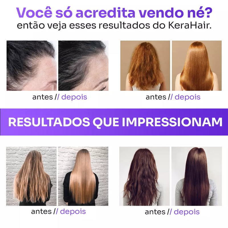 Cabelos Lindos e Revitalizados - KeraHair [COMPRE 1 LEVE 5]